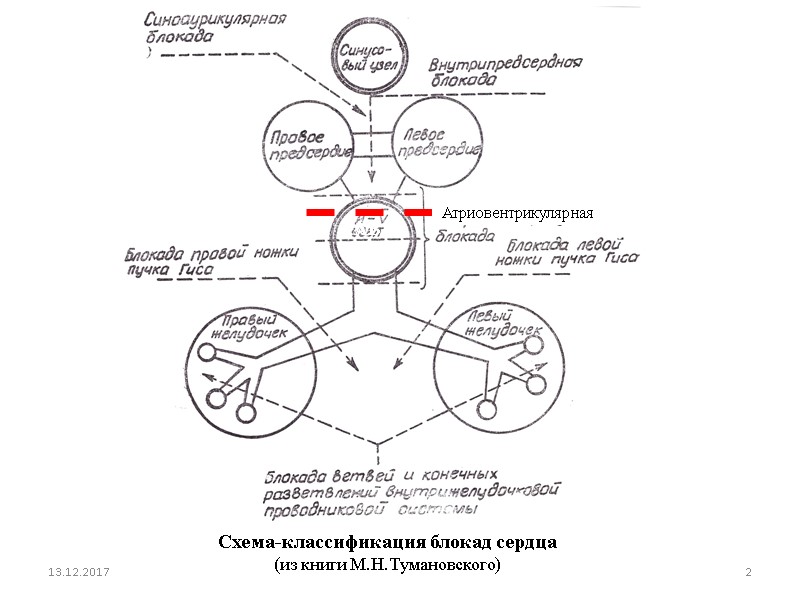 13.12.2017 2 Схема-классификация блокад сердца  (из книги М.Н.Тумановского) AВ-  узел  Атриовентрикулярная